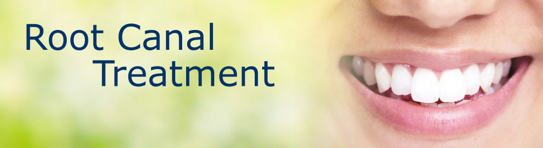 Root Canal Treatment